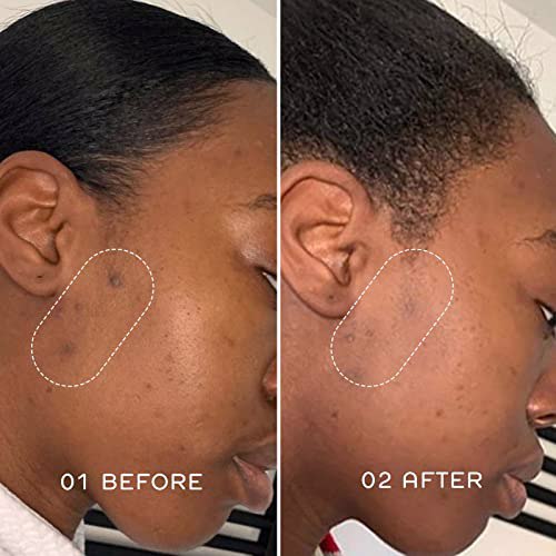 تاثیر استفاده از کرم ضدلک Axis-Y مدل Dark Spot Correcting Glow Serum حجم 50 میل 