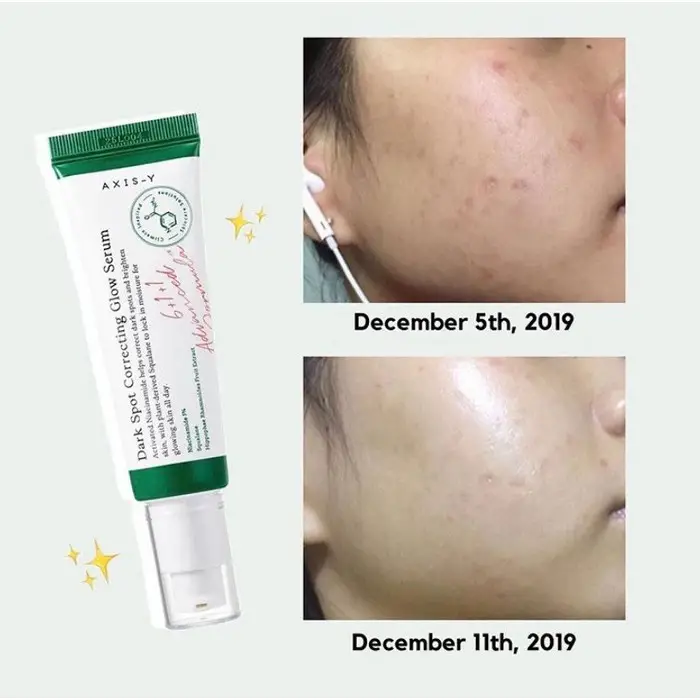 کاهش لکههای تیره و جای جوش با سرم ضد لک Axis-Y