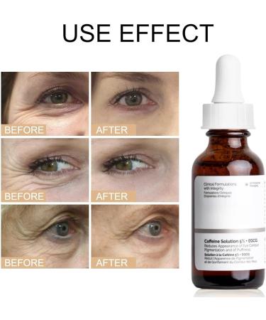 کاهش پف و تیرگی دور چشم پس از استفاده منظم از سرم کافئین The Ordinary