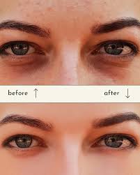 روشن‌کننده، ضد پف و کاهش‌دهنده تیرگی دور چشم