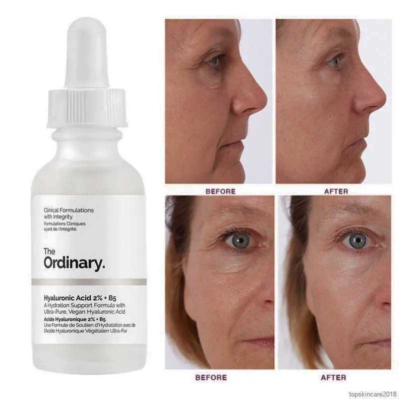 بهبود خشکی و پر شدن خطوط ریز پس از استفاده منظم