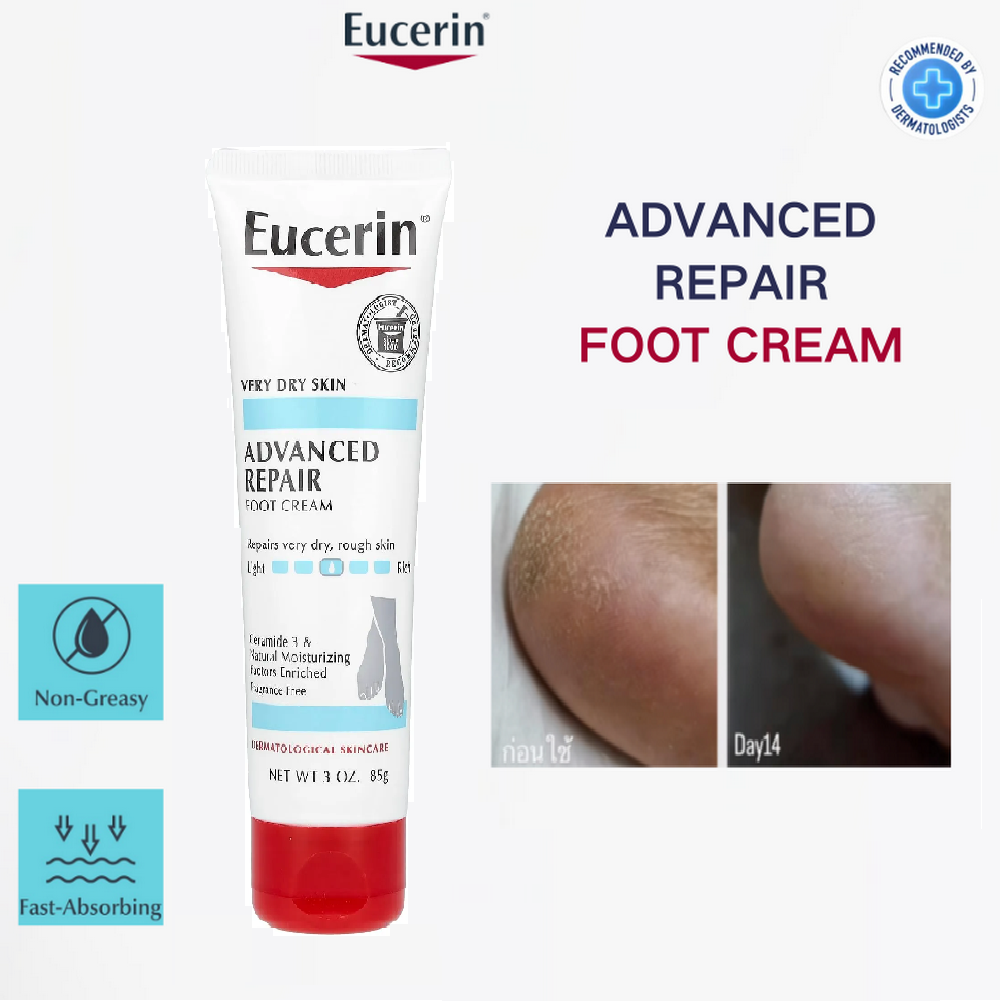 کرم پا اوسرین مناسب پوست بسیار خشک