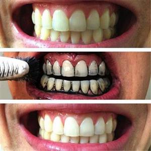 نتیجه استفاده از خمیر دندان ایوب صبری Eyüp Sabri زغال بامبو سفید کننده حجم 90 میل