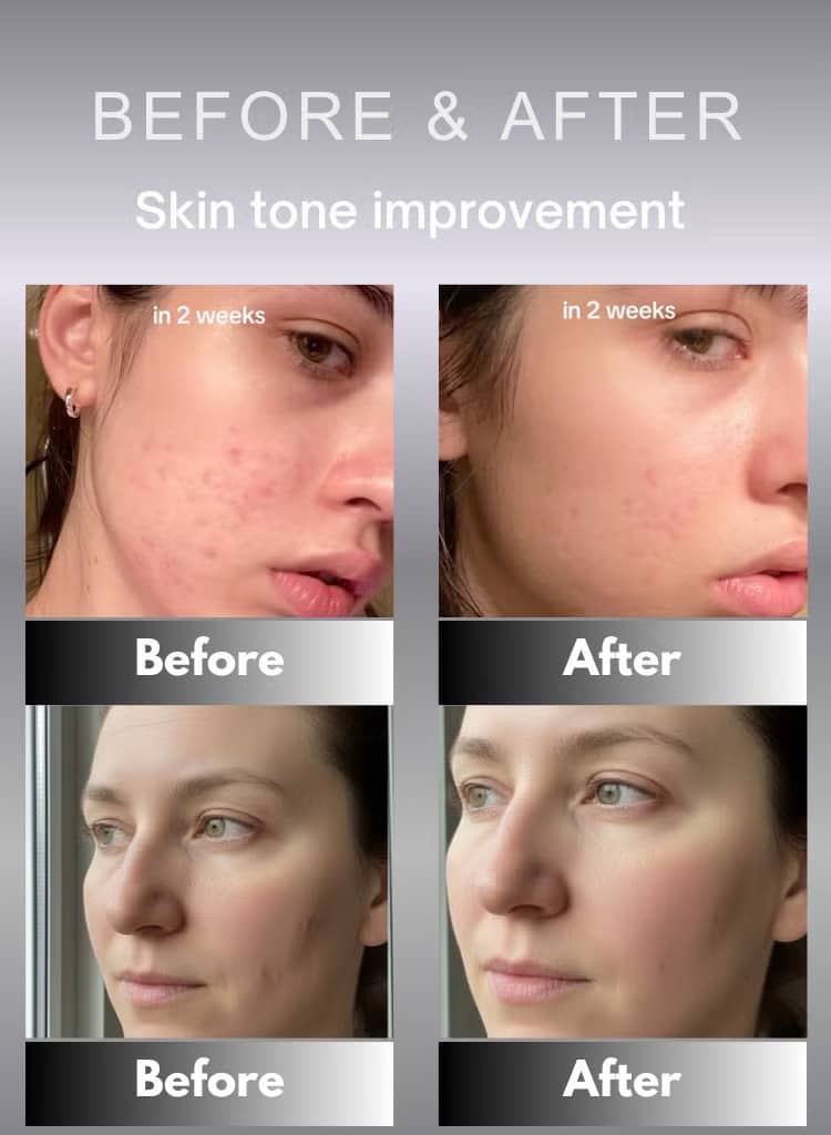 سرم ضدچروک رتینال شات سلیمکس Celimax حجم 30 میل | جوان‌کننده، سفت‌کننده و بهبود بافت پوست