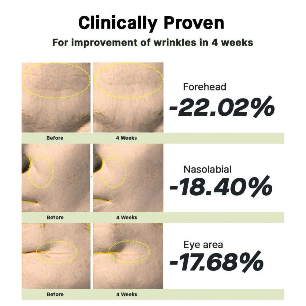 کاهش چروک صورت با سرم رتینول کوزارکس